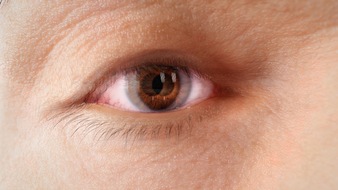 Amgen GmbH: Endokrine Orbitopathie: Amgen lenkt den Blick auf Versorgungsl&uuml;cken und gesellschaftliche Folgen