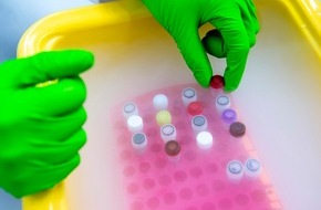 Helmholtz Munich: Helmholtz Launches Task Force to Strengthen Prevention Research