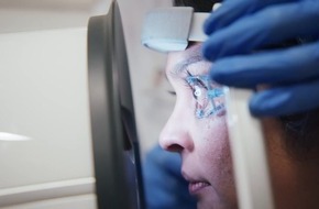 Neue kontaktlose Therapieoption Glaukom - BELKIN Vision Eagle Direkte Selektive Lasertrabekuloplastik (DSLT) ab jetzt als Ersttherapie in Deutschland verfügbar