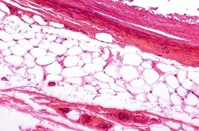 Helmholtz Munich: Neues Wissensportal Adiposetissue.org stärkt die Adipositas- und Stoffwechselforschung durch zentralisierte Daten