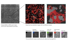 Fraunhofer-Institut für Produktionstechnologie IPT: Fraunhofer IPT und Partner entwickeln Software zur automatisierten Analyse von Zellkulturen