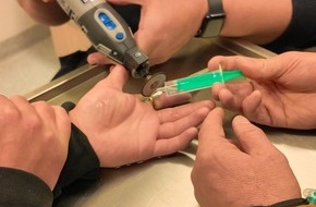 Kreisfeuerwehr Oldenburg: FW-OLL: Ring schnürt Finger ab - Feuerwehr entfernt Ring in der Notaufnahme