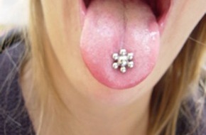 Schweizerische Zahnärzte-Gesellschaft SSO: Societa Svizzera di Odontologia e Stomatologia: Il piercing - una moda esotica con effetti collaterali