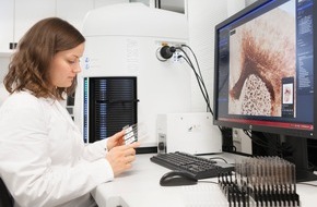 AbbVie Deutschland GmbH & Co. KG: Alzheimer-Therapie: Auftakt für neues Forschungsprojekt von AbbVie Deutschland und BioMed X