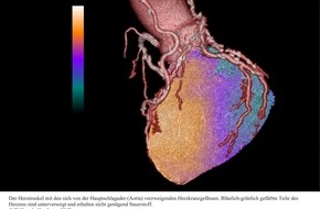 Schweizerischer Nationalfonds / Fonds national suisse: SNF: Bild der Forschung Mai 2010: Kombiniertes Bildgebungsverfahren verbessert Diagnose