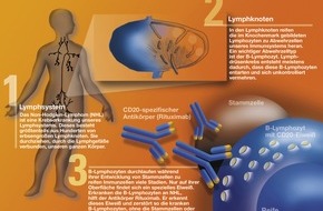 Roche Pharma AG: Lymphome sind heilbar / Neue Therapie kann jährlich 1.000 Menschenleben retten