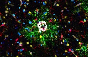 Universit&auml;t Augsburg: Einblicke ins Alzheimer-Gehirn: bislang unbekannte Immunzell-Population gefunden
