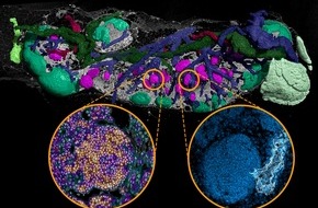 Helmholtz-Zentrum Hereon: Hereon PM: Verborgene Bereiche in Lymphknoten