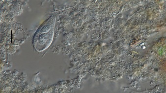 Universität Koblenz: Ökologische Wechselwirkungen in Kläranlagen beeinflussen Antibiotikaresistenzen - Pressemitteilung der Universität Koblenz