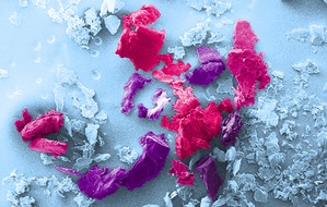BAM Bundesanstalt für Materialforschung und -prüfung: Toxizität von Mikro- und Nanoplastik: BAM forscht zu den Risiken winziger Polymer-Partikel