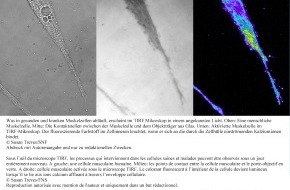 Schweizerischer Nationalfonds / Fonds national suisse: FNS: Image de la recherche: Un microscope nouvelle génération ouvre des perspectives inédites sur les cellules musculaires