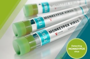 R-Biopharm AG: R-Biopharm announces test to detect monkeypox virus