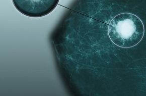 Novartis Pharma GmbH: Letrozol erhält in der Schweiz die Zulassung als einzige Post-Tamoxifen-Behandlung von Brustkrebs im Frühstadium