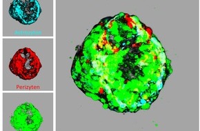 Universität Duisburg-Essen: Schlaganfallforschung ohne Tierversuche: „Mini-brains“ statt Mausmodell