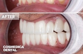 Cosmedica Dental: Zahnaufhellung Türkei: Professionelle und schnelle Behandlung bei Cosmedica Dental