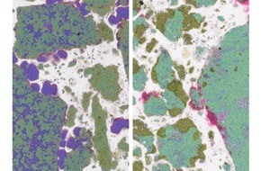 Helmholtz-Zentrum Hereon: Hereon PM - Mikrometerfeine Körnchen, mit Polymeren umhüllt