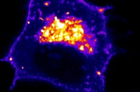 Helmholtz Zentrum München: Inceptor reguliert Insulinhaushalt: Neuer Ansatz für Diabetes-Therapien