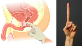 VITUS Privatklinik Prof. Dr. Stehling GmbH: Prostatakrebsvorsorge: Abtasten bringt nichts! / PSA-Test und MRT setzen sich durch