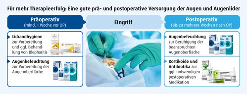 Ursapharm Arzneimittel GmbH: Pressemitteilung: URSAPHARM klärt mit Informationskampagne über prä- und postoperative Versorgung der Augen und Augenlider auf