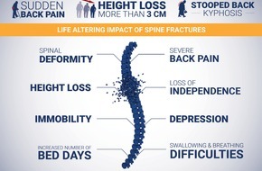 The International Osteoporosis Foundation (IOF): IOF rät: Auf Warnzeichen der Wirbelsäule achten