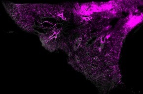 Helmholtz Munich: SCP-Nano: A New Technology to Visualize Nanocarriers in Cells and Tissues