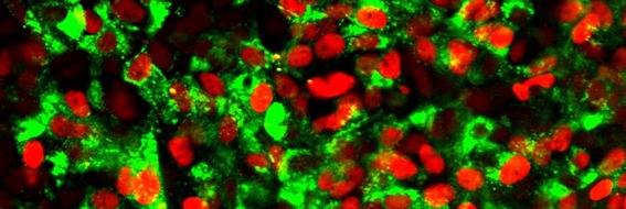 Helmholtz Zentrum München: Stammzellen werden zu Betazellen: Neue Chancen für die Zellersatztherapie