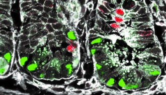 Helmholtz Zentrum München: Stammzellen im Darm: Neue Erkenntnisse könnten Weg für die Behandlung zahlreicher Krankheiten ebnen