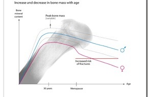DSM Nutritional Products AG: Schutz vor Osteoporose - Knochen, ein lebendes Gewebe