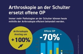 AGA Gesellschaft für Arthroskopie und Gelenkchirurgie: Tag der Arthroskopie am 1. Februar 2019 / Ärzte in Deutschland, Österreich und der Schweiz klären am "Tag der Arthroskopie" über Behandlungsmöglichkeiten erkrankter und verletzter ...