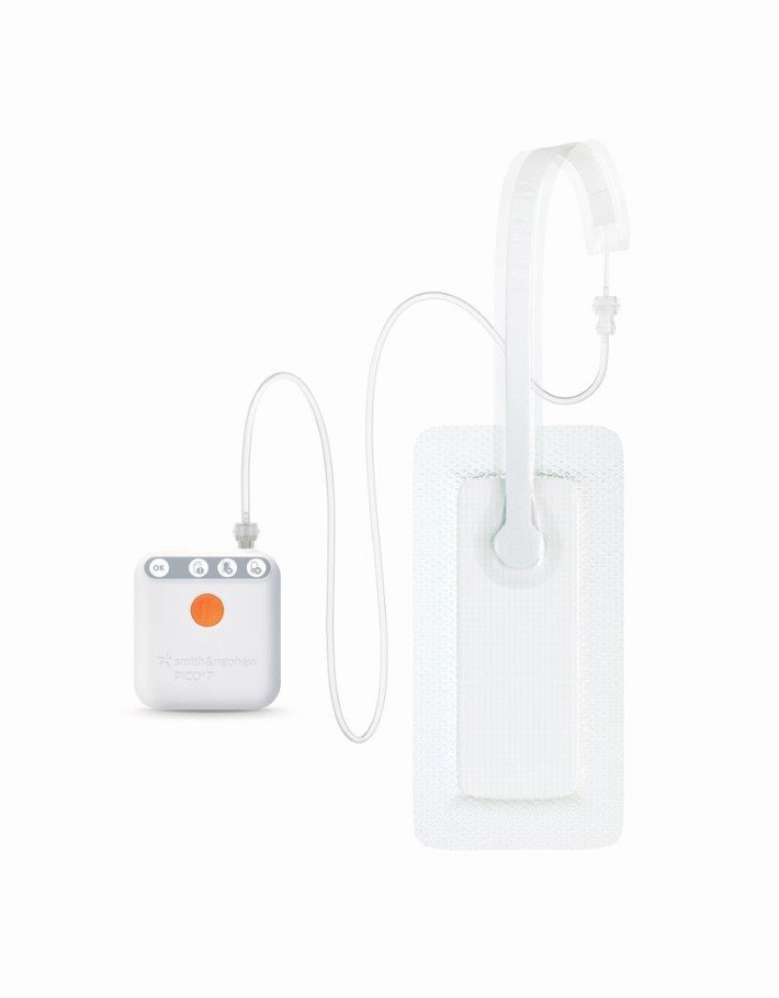 Le système de traitement des plaies par pression négative sans réservoir PICO de Smith & Nephew réduit de manière significative les complications postopératoires du site chirurgical