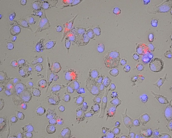 Mukoviszidose e.V. finanziert Forschungsprojekt zur Mycobacterium abscessus-Therapie