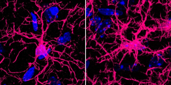 Anti-Aging fürs Gehirn? Studie liefert neue Erkenntnisse über altersbedingte Hirnveränderungen