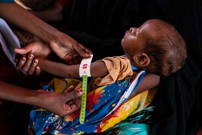 UN-Report: Jeder neunte Mensch leidet Hunger
