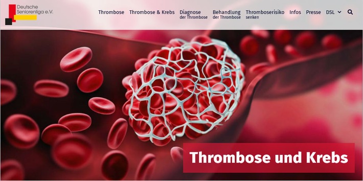 Krebserkrankung birgt hohes Risiko für Venenthrombose