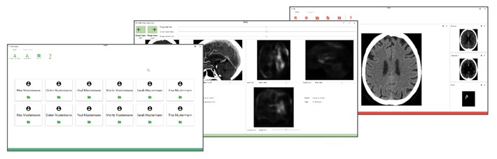 Medica 2023: Medizinische Bilddaten mit neuer Technologie einfacher und sicher analysieren und visualisieren