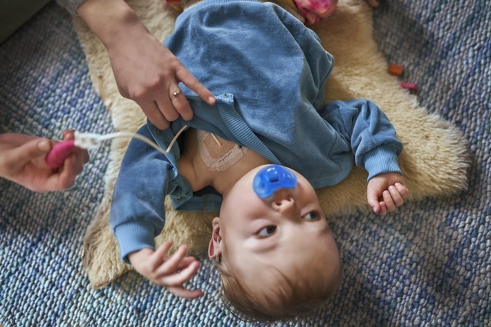 Baby mit Kurzdarmsyndrom und zentralem Venenkatheter trägt adaptives Sweatshirt von Wombly / Weiterer Text über ots und www.presseportal.de/nr/170010 / Die Verwendung dieses Bildes für redaktionelle Zwecke ist unter Beachtung aller mitgeteilten Nutzungsbedingungen zulässig und dann auch honorarfrei. Veröffentlichung ausschließlich mit Bildrechte-Hinweis.