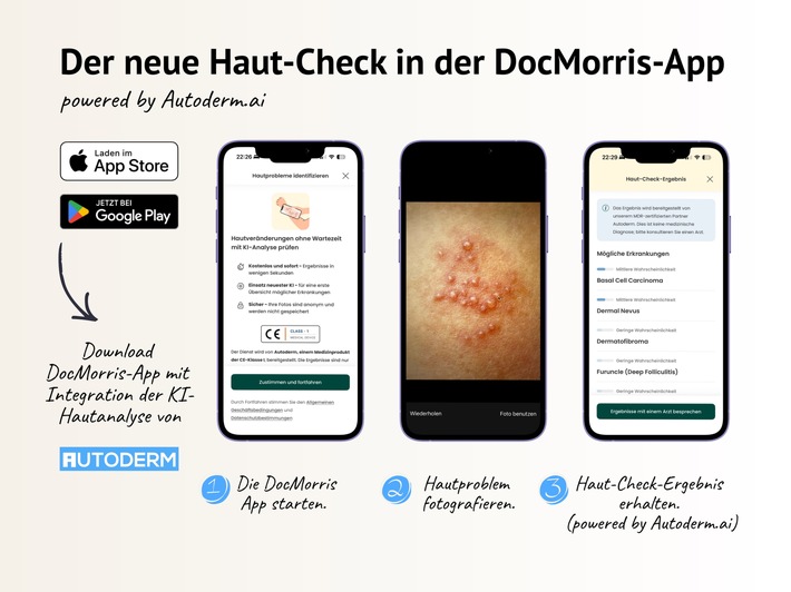 Autoderm ergänzt digitales Gesundheitsökosystem von DocMorris mit KI-Hautanalyse