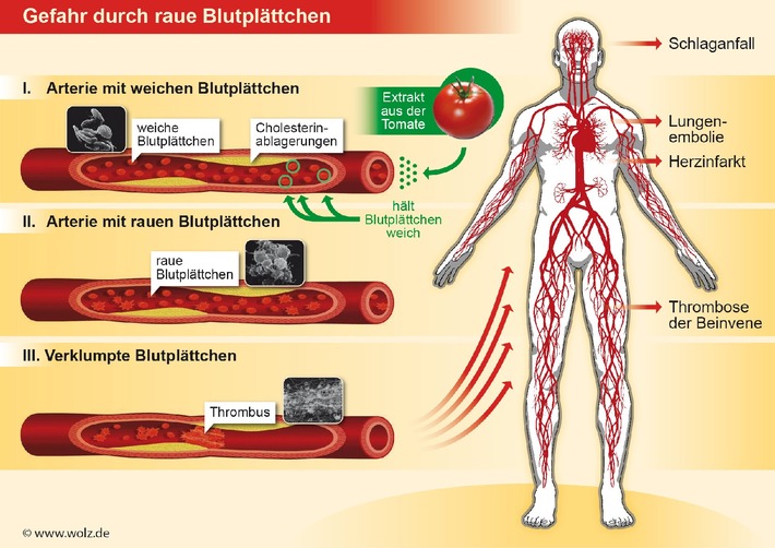 Extrakt aus der Tomate hemmt Blutverklumpung / Neues bahnbrechendes Naturpräparat sorgt für gesunden Blutfluss (BILD)