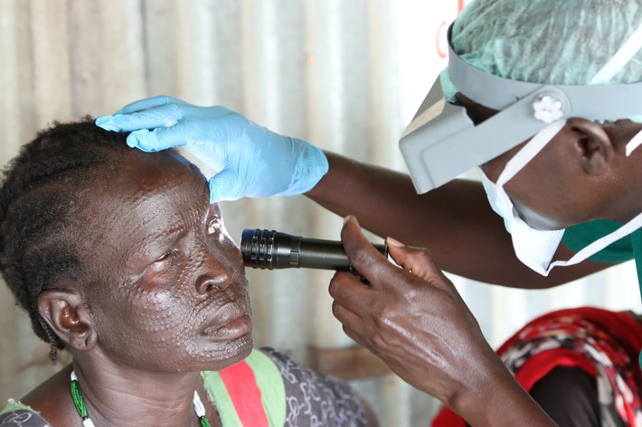 Nach der Flucht droht Blindheit / Christoffel-Blindenmission unterstützt Trachom-Behandlungen in Flüchtlingslager im Südsudan
