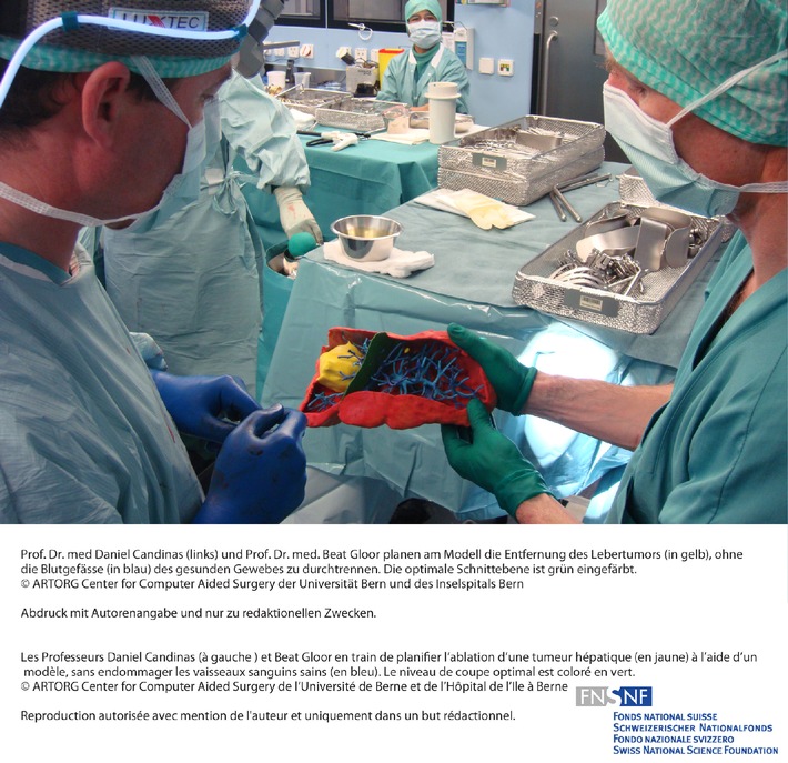 FNS: Image du mois avril 2009: Planifier une intervention chirurgicale grâce des modèles 3D individuels d&#039;organes