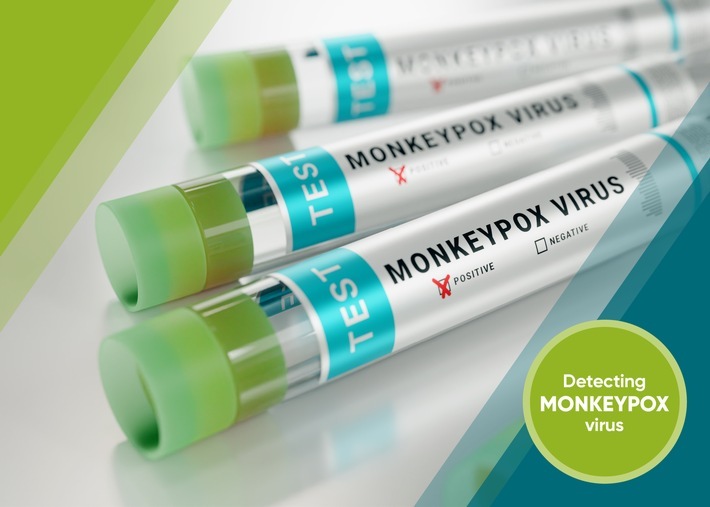 Zur Verfolgung und Kontrolle der Ausbreitung des Affenpockenvirus entwickelt R-Biopharm einen Test für Forschungszwecke. / Weiterer Text über ots und www.presseportal.de/nr/129757 / Die Verwendung dieses Bildes ist für redaktionelle Zwecke unter Beachtung ggf. genannter Nutzungsbedingungen honorarfrei. Veröffentlichung bitte mit Bildrechte-Hinweis.