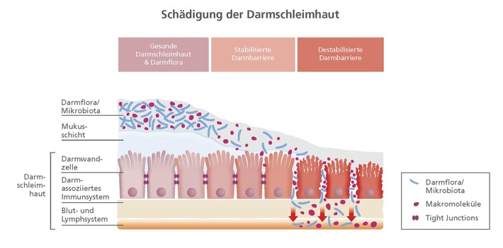 Neue Studien rücken Darmbarriere in den Fokus / Gastroenterologe empfiehlt: Bei anhaltenden Verdauungsbeschwerden Darmbarriere prüfen lassen