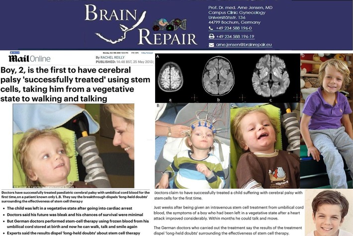 Breakthrough - EUR 50 million investment for start-up BrainRepair UG / Pivotal trial on stem cell treatment for brain damage in newborns fully funded