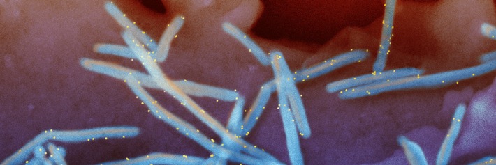 RS-Virus Infektionen - nicht nur gute Handhygiene ist wichtig