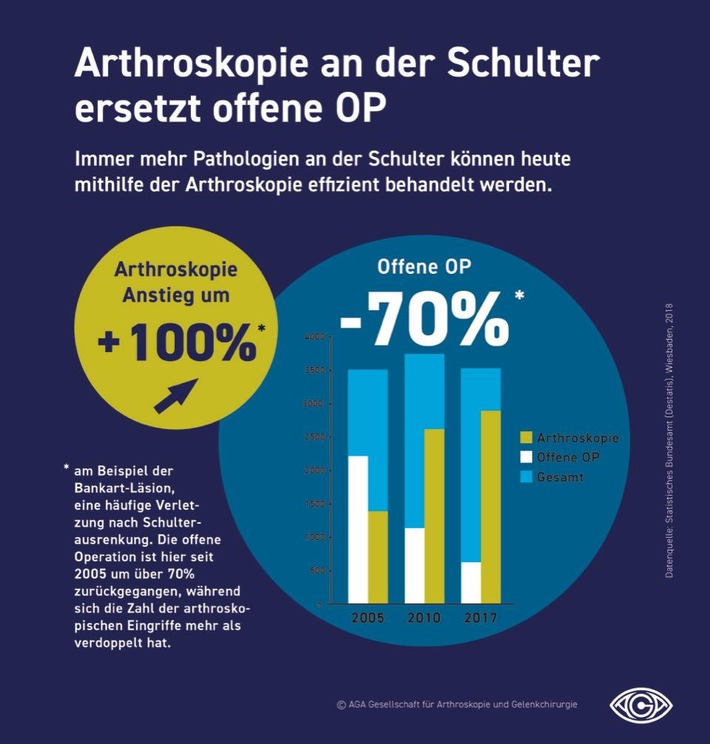 Tag der Arthroskopie am 1. Februar 2019 / Ärzte in Deutschland, Österreich und der Schweiz klären am &quot;Tag der Arthroskopie&quot; über Behandlungsmöglichkeiten erkrankter und verletzter Gelenke auf