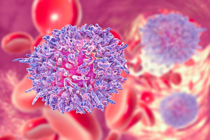 Welt-CLL-Tag und Welt-Blutkrebsmonat: Engagement für eine bessere Zukunft der Patient:innen