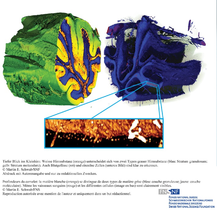 FNS: Image de la recherche août 2010 : Radiographie : un procédé fournit des vues plus précises