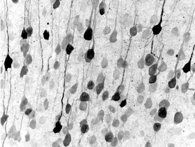 Direkte neuronale Umprogrammierung: Eine vielversprechende Methode, um Nervenzellen nach Verlust aus körpereigenen Zellen zu erzeugen