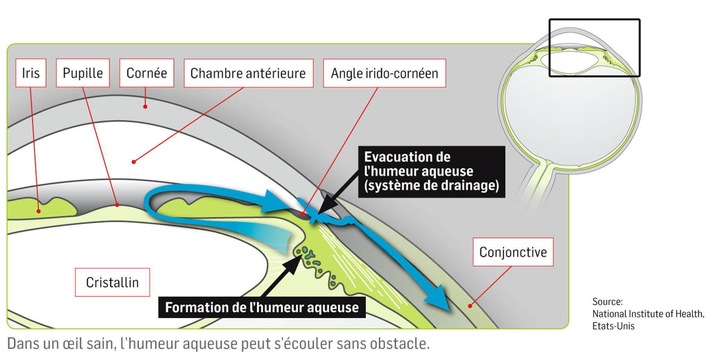 Examens ophtalmologiques gratuits en mars dans toute la Suisse: Une campagne de prévention des ophtalmologues suisses