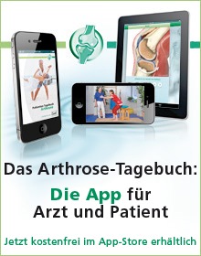 Neue App für Arthrose-Patienten (BILD)